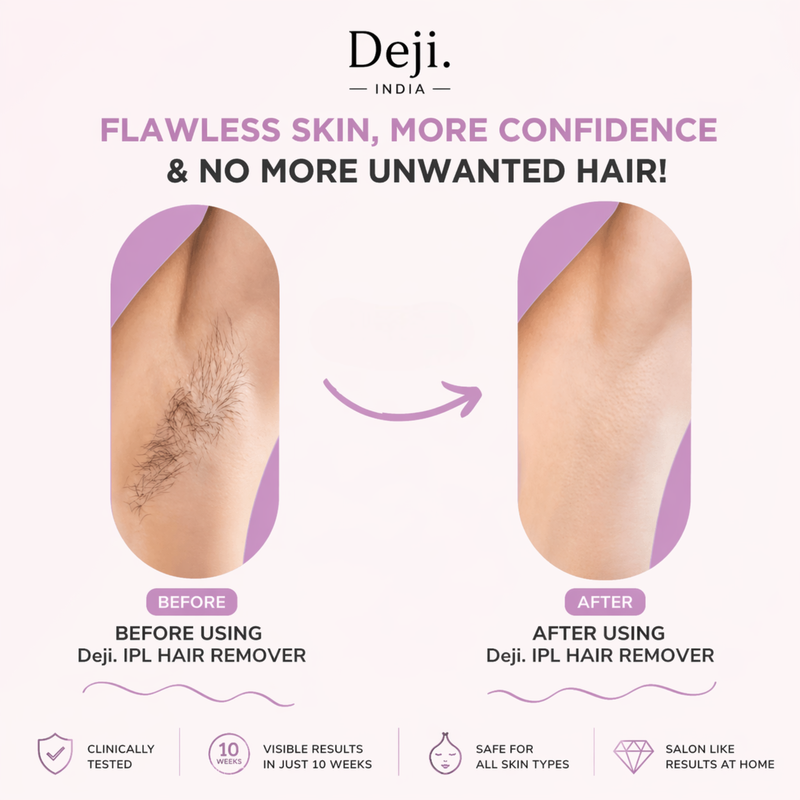 ADVANCED IPL HAIR REMOVAL DEVICE – SALON SMOOTH SKIN AT HOME